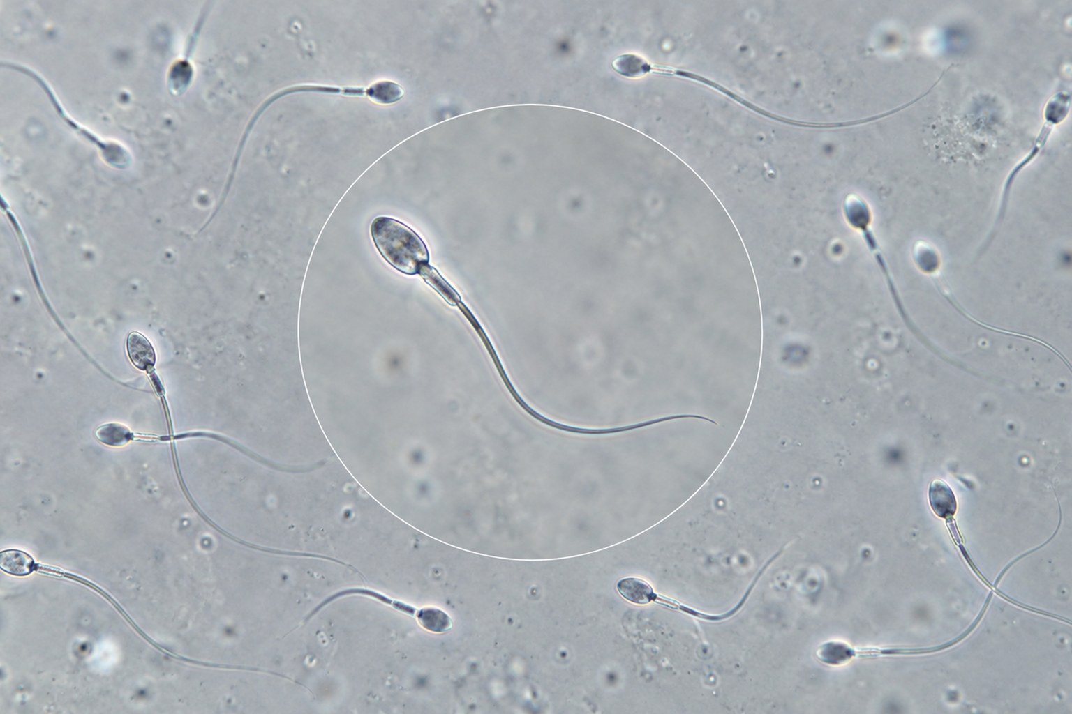 Muestra de semen en laboratorio para espermograma