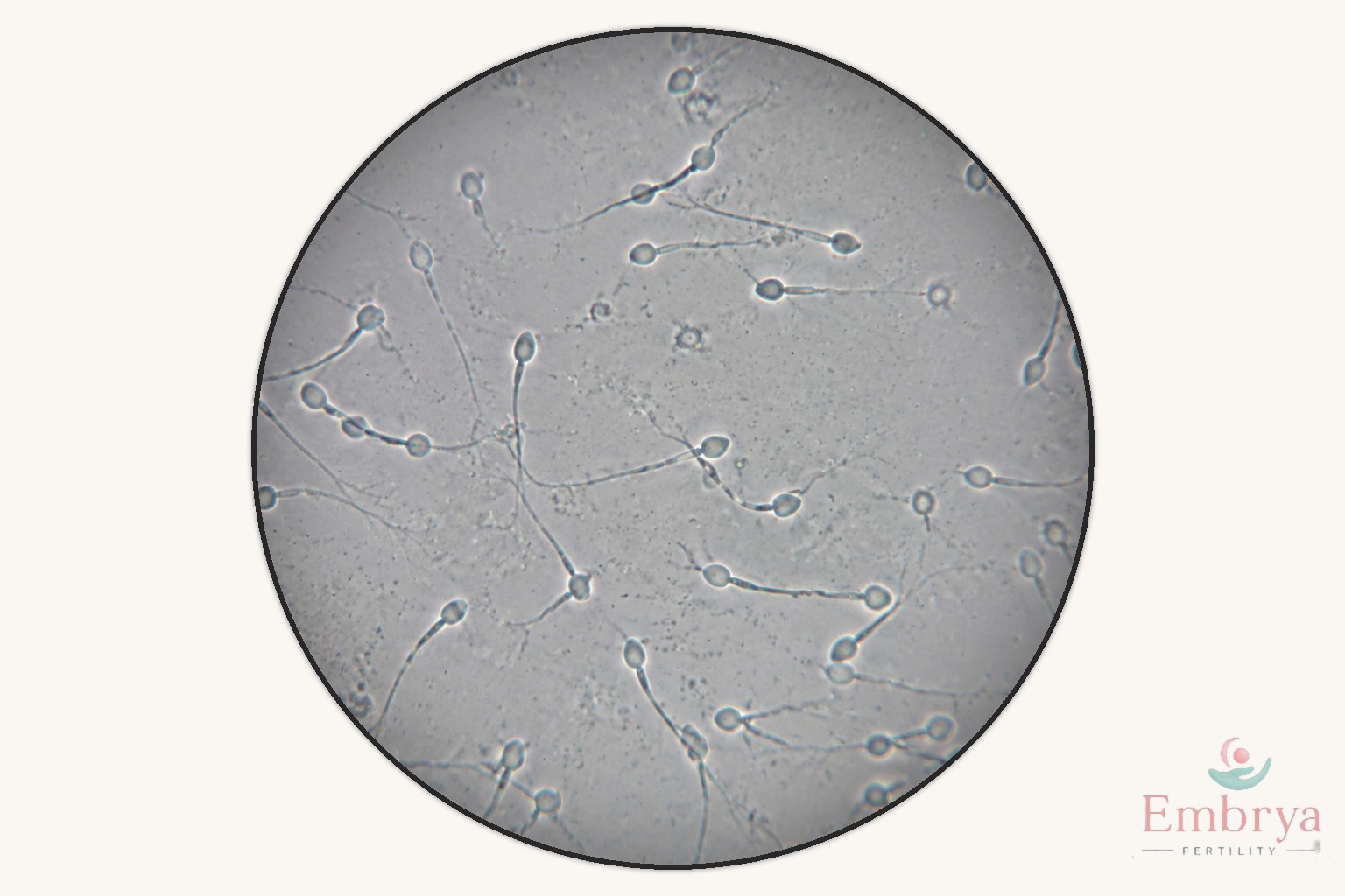 Fertilidad masculina