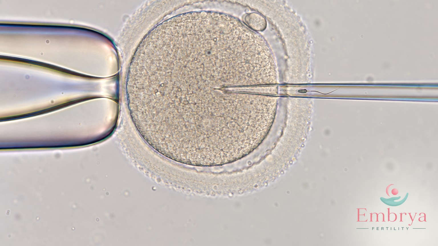 Tratamientos de fertilidad
